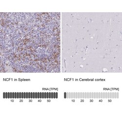 NCF1 Antibody, Novus Biologicals 25 &mu;L, Unlabeled:Antibodies, Polyclonal